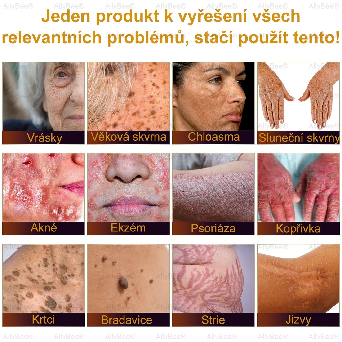 👨🔬AllyBee® Botox Krém na ošetření pleti proti stárnutí, hydratační, oprava pleti, vyrovnání tónu pleti, léčba akné a tmavých skvrn, odstraňování bradavic a mateřských znamének