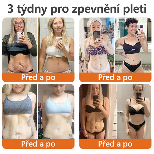 【Oficiální vlajkový obchod】TLOPA®🌿 AH-8 Botox a zpevňující krém s mateří kašičkou (🔥Doporučeno renomovanými dermatology)