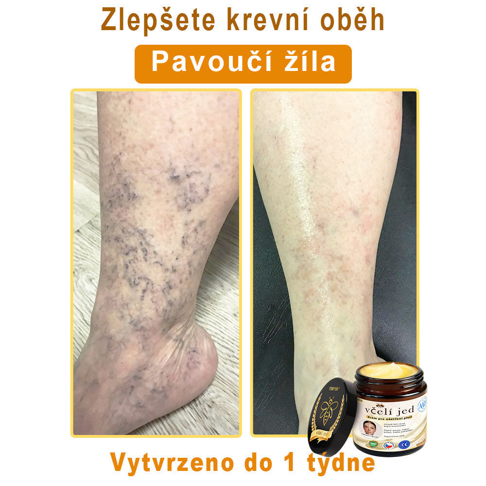 💥Doporučeno Univerzitní nemocnicí Motok | Oficiální obchod | YSMYSM® Krém na opravu pleti pro celé tělo: proti stárnutí, hydratace, oprava pleti, sjednocení tónu pleti, léčba akné a tmavých skvrn, odstraňování bradavic a znamének, úleva při psoriáze