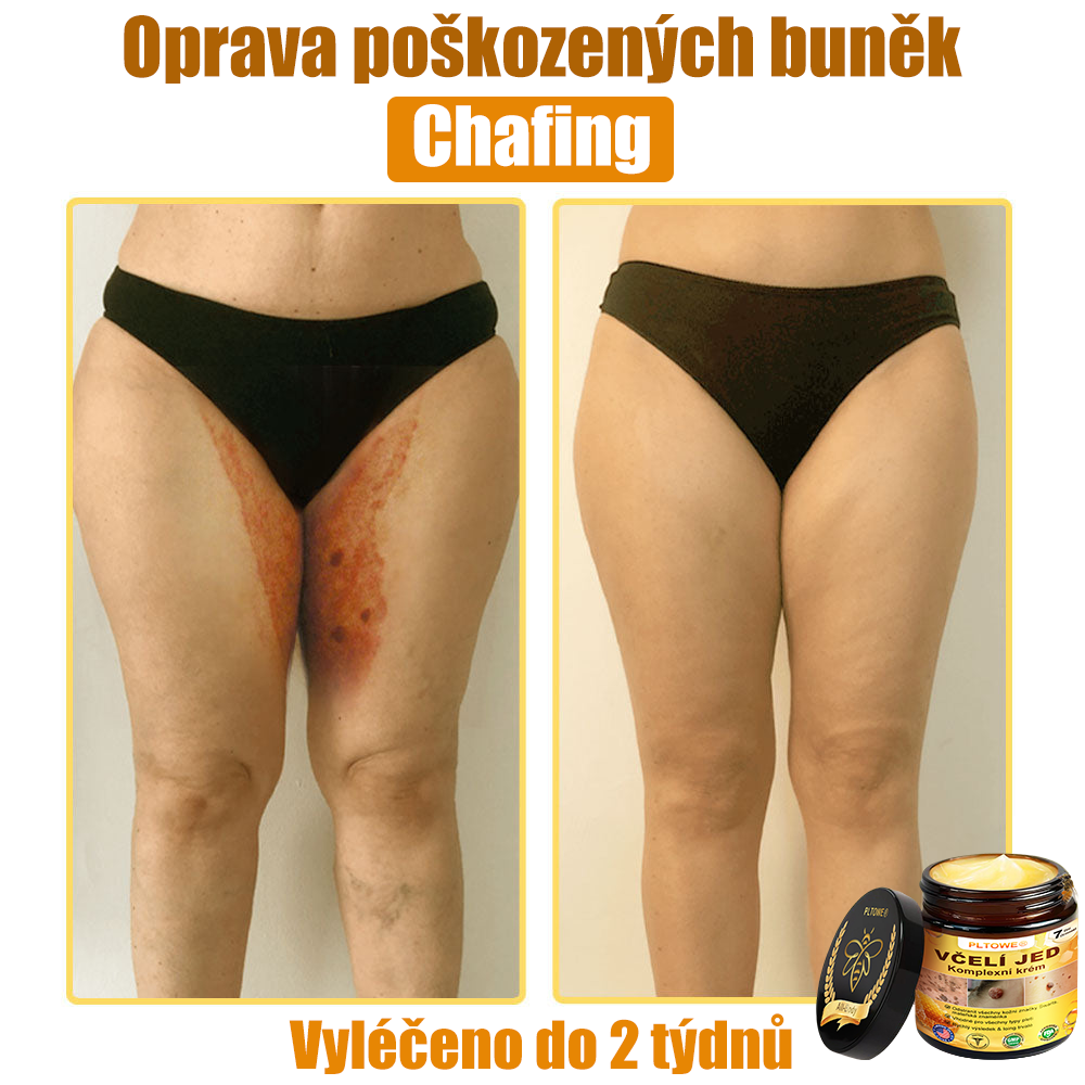 💥💥PLTOWE® Včelí jed All-in-One krém Schváleno dermatologem