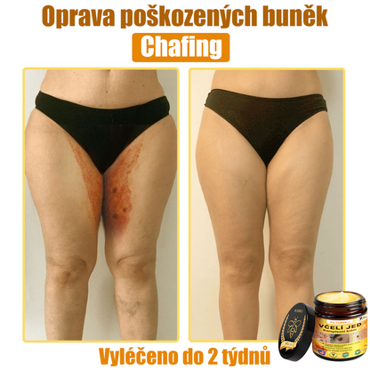 💥💥PLTOWE® Včelí jed All-in-One krém Schváleno dermatologem