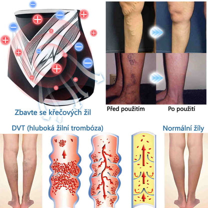 Sfrcord™ Tvarovací šortky z titanových vláken s turmalínem a samovýhřevem 🔥 Časově omezená nabídka – sleva až 80 %