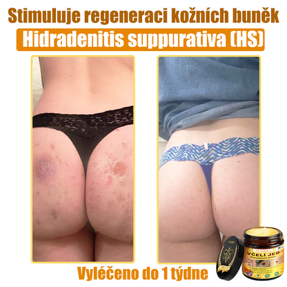💥💥PLTOWE® Včelí jed All-in-One krém Schváleno dermatologem
