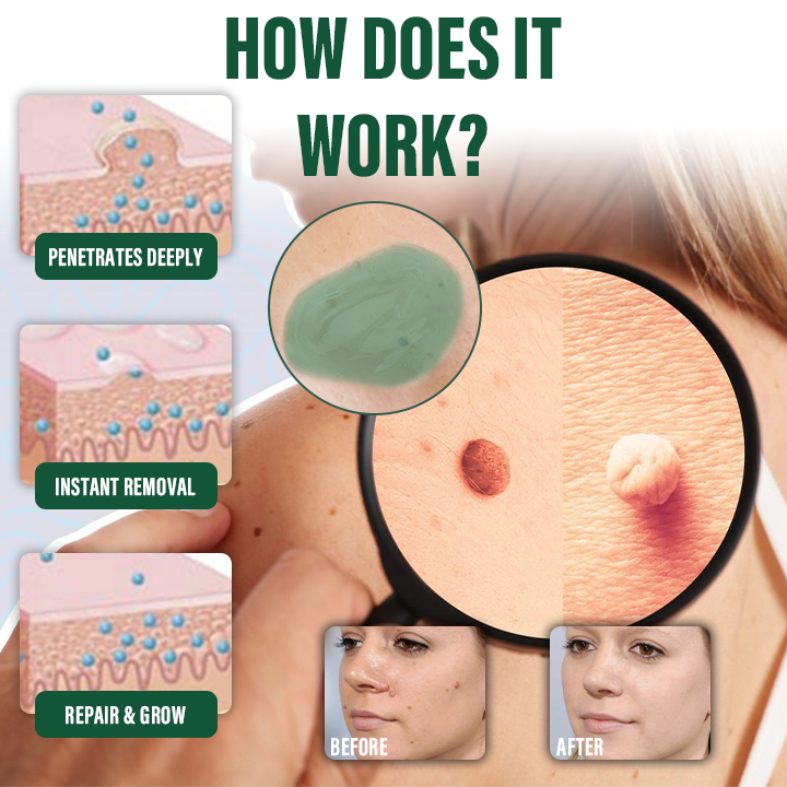 🌿Ceoerty® DermaErase gel na okamžité odstranění znamének a skvrn