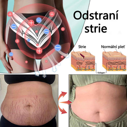 Sfrcord™ Tvarovací šortky z titanových vláken s turmalínem a samovýhřevem 🔥 Časově omezená nabídka – sleva až 80 %