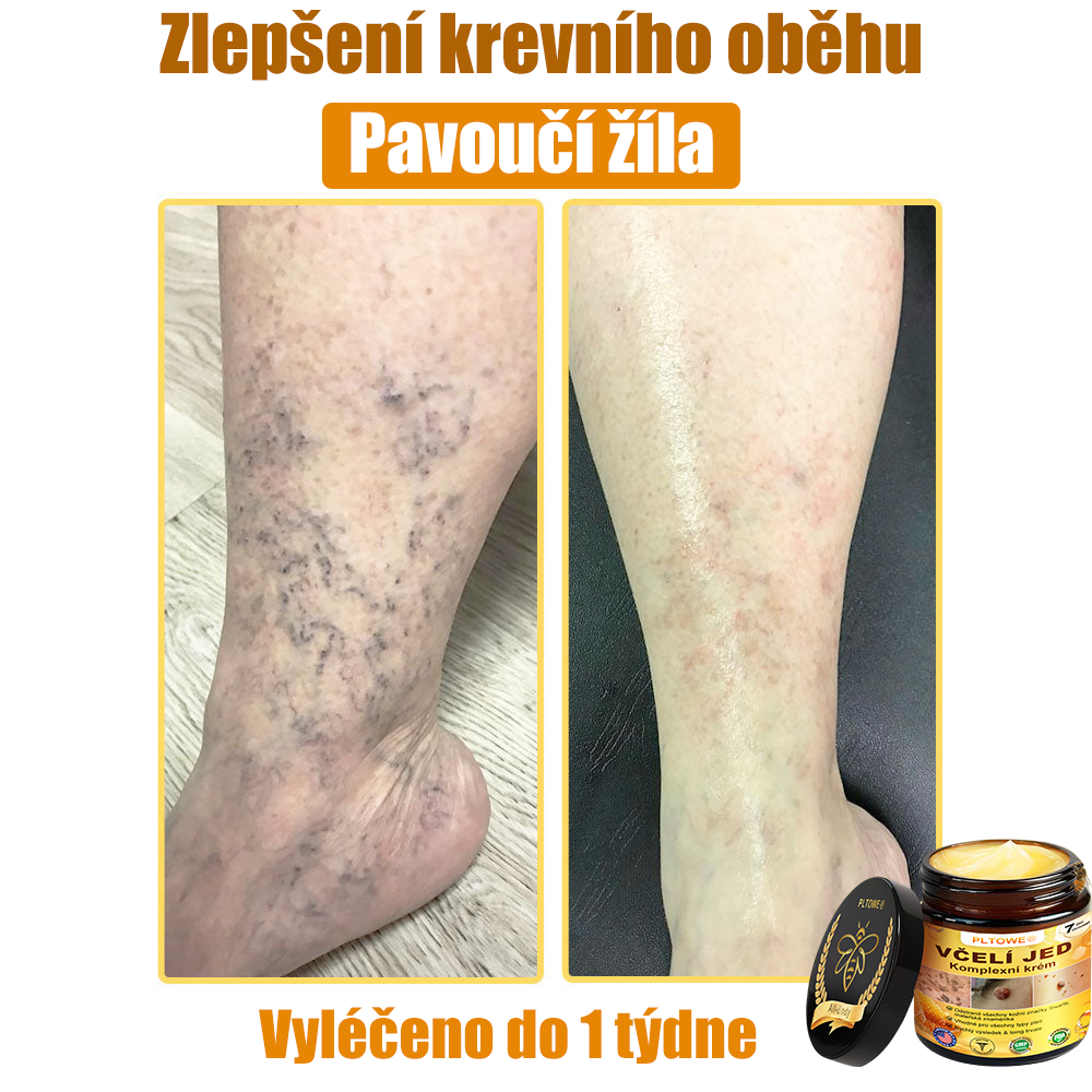 💥💥PLTOWE® Včelí jed All-in-One krém Schváleno dermatologem