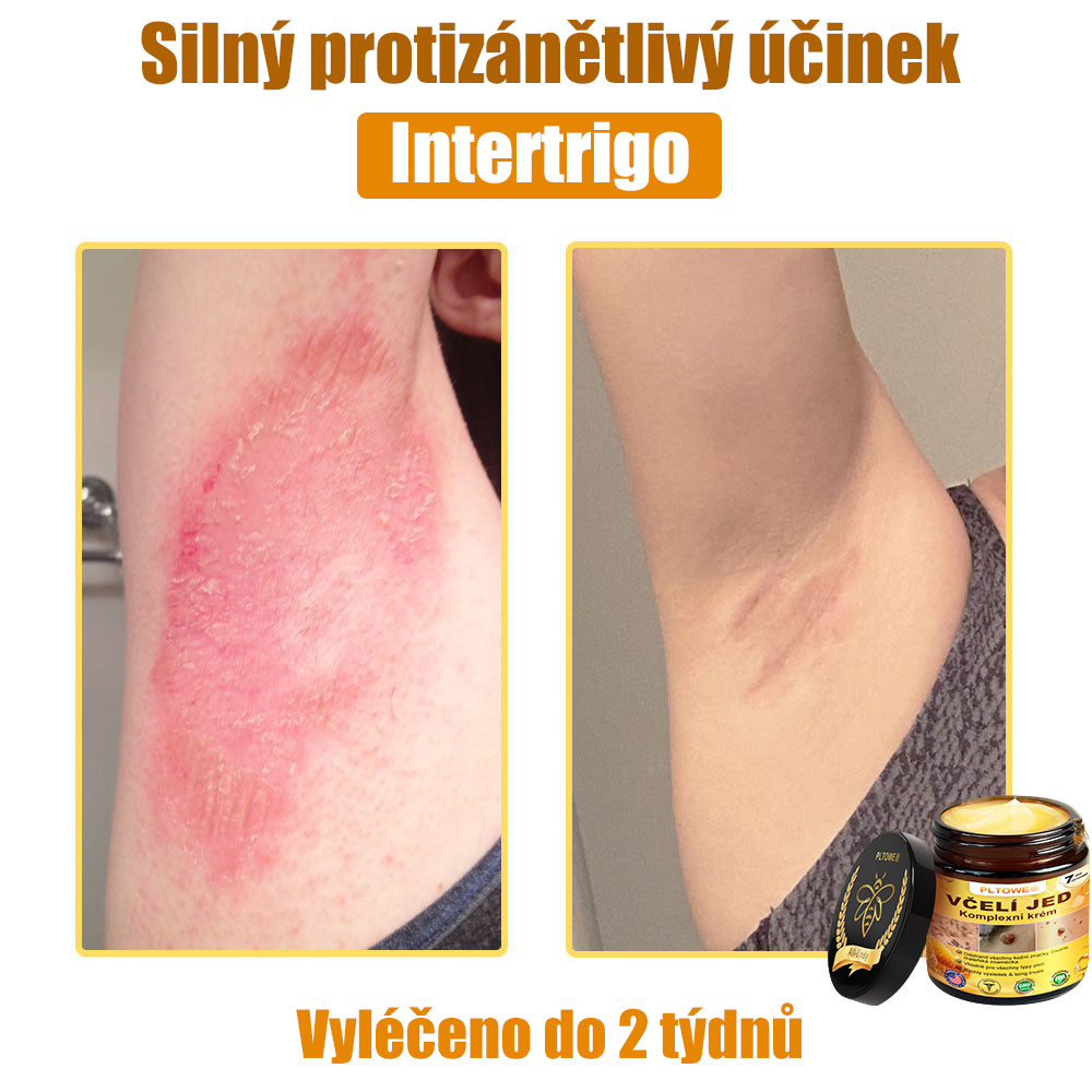 💥💥PLTOWE® Včelí jed All-in-One krém Schváleno dermatologem