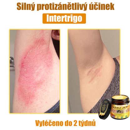 💥💥PLTOWE® Včelí jed All-in-One krém Schváleno dermatologem