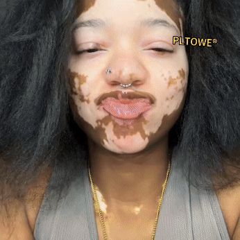 💥Doporučeno Univerzitní nemocnicí Motok | Oficiální obchod | YSMYSM® Krém na opravu pleti pro celé tělo: proti stárnutí, hydratace, oprava pleti, sjednocení tónu pleti, léčba akné a tmavých skvrn, odstraňování bradavic a znamének, úleva při psoriáze