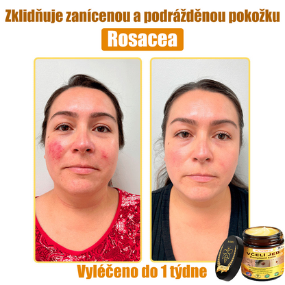 💥💥PLTOWE® Včelí jed All-in-One krém Schváleno dermatologem