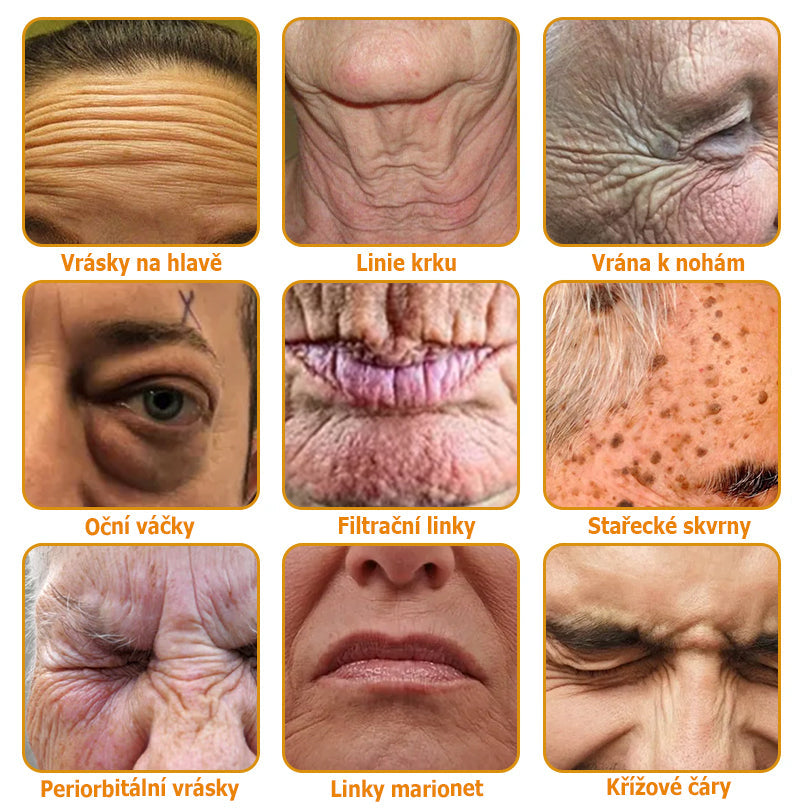 👨‍🔬AllyBee® Botox Krém na ošetření pleti proti stárnutí, hydratační, oprava pleti, vyrovnání tónu pleti, léčba akné a tmavých skvrn, odstraňování bradavic a mateřských znamének