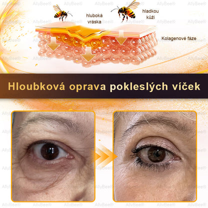 👨‍🔬AllyBee® Botox Krém na ošetření pleti proti stárnutí, hydratační, oprava pleti, vyrovnání tónu pleti, léčba akné a tmavých skvrn, odstraňování bradavic a mateřských znamének