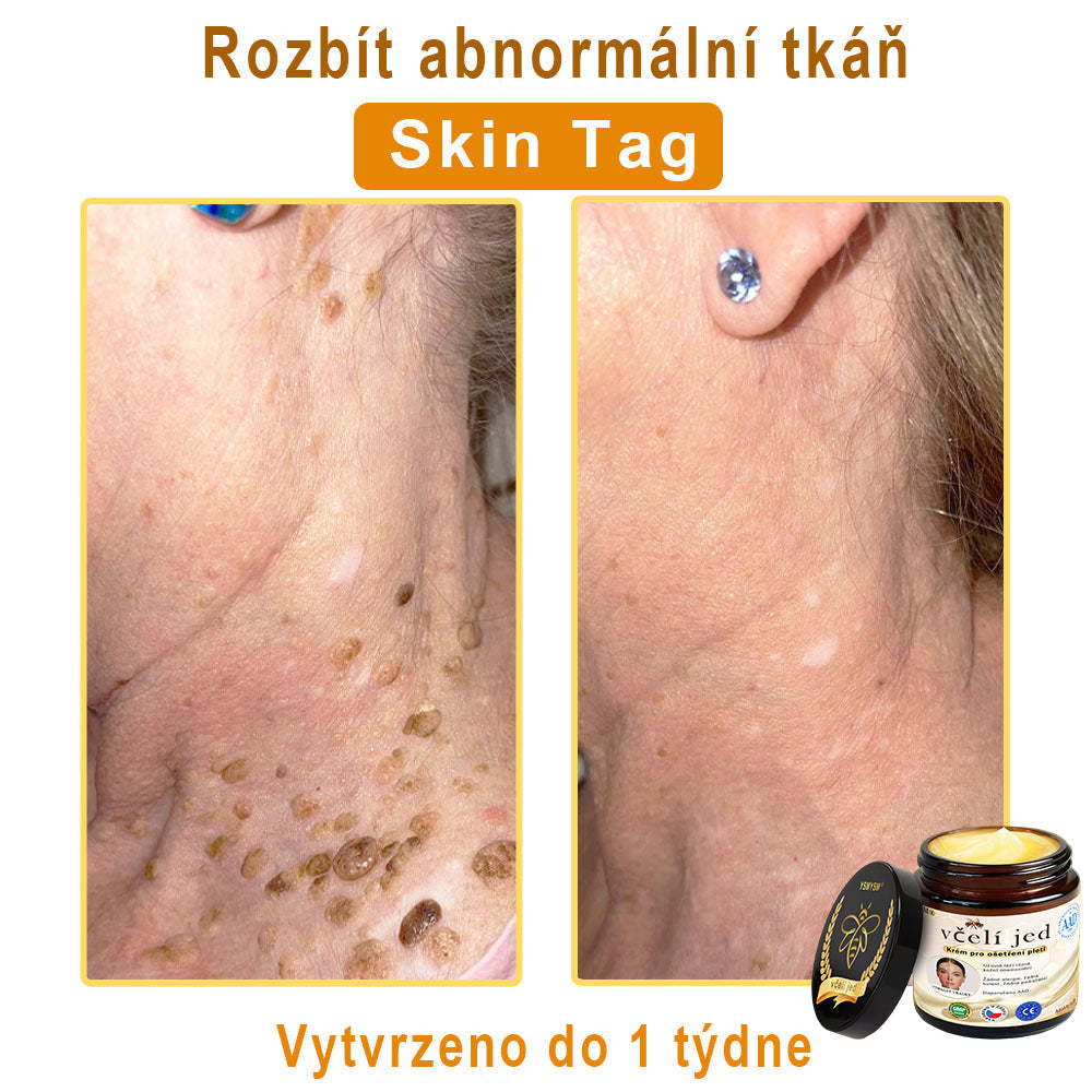 💥Doporučeno Univerzitní nemocnicí Motok | Oficiální obchod | YSMYSM® Krém na opravu pleti pro celé tělo: proti stárnutí, hydratace, oprava pleti, sjednocení tónu pleti, léčba akné a tmavých skvrn, odstraňování bradavic a znamének, úleva při psoriáze