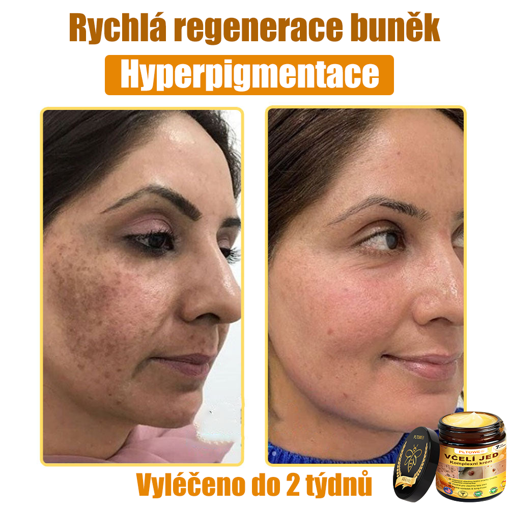 💥💥PLTOWE® Včelí jed All-in-One krém Schváleno dermatologem
