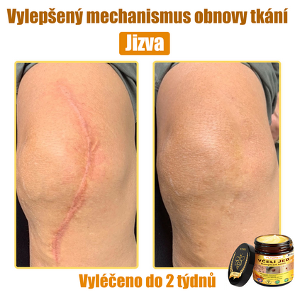 💥💥PLTOWE® Včelí jed All-in-One krém Schváleno dermatologem