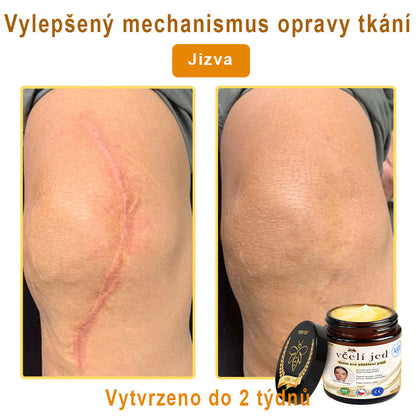 💥Doporučeno Univerzitní nemocnicí Motok | Oficiální obchod | YSMYSM® Krém na opravu pleti pro celé tělo: proti stárnutí, hydratace, oprava pleti, sjednocení tónu pleti, léčba akné a tmavých skvrn, odstraňování bradavic a znamének, úleva při psoriáze