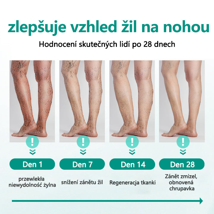 [Oficiální obchod značky]Timilk® Obnova nohou náplast na křečové žíly