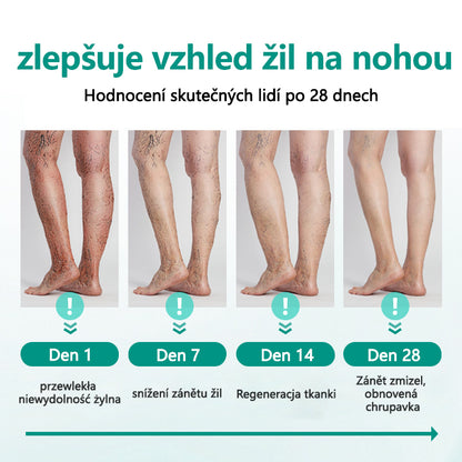 [Oficiální obchod značky]Timilk® Obnova nohou náplast na křečové žíly