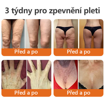【Oficiální vlajkový obchod】TLOPA®🌿 AH-8 Botox a zpevňující krém s mateří kašičkou (🔥Doporučeno renomovanými dermatology)
