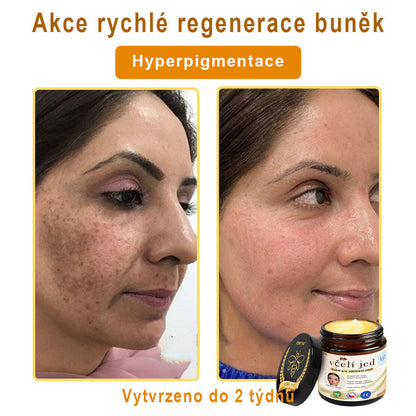 💥Doporučeno Univerzitní nemocnicí Motok | Oficiální obchod | YSMYSM® Krém na opravu pleti pro celé tělo: proti stárnutí, hydratace, oprava pleti, sjednocení tónu pleti, léčba akné a tmavých skvrn, odstraňování bradavic a znamének, úleva při psoriáze