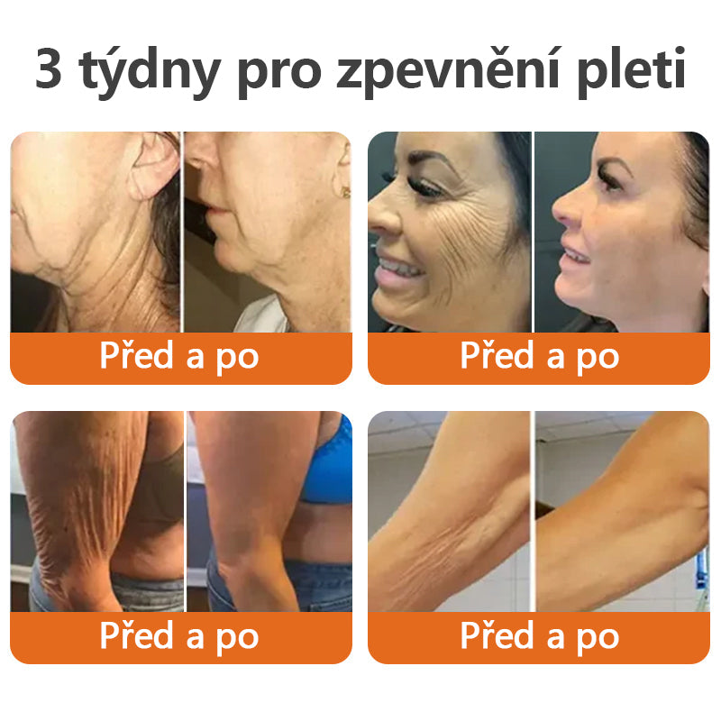 【Oficiální vlajkový obchod】TLOPA®🌿 AH-8 Botox a zpevňující krém s mateří kašičkou (🔥Doporučeno renomovanými dermatology)