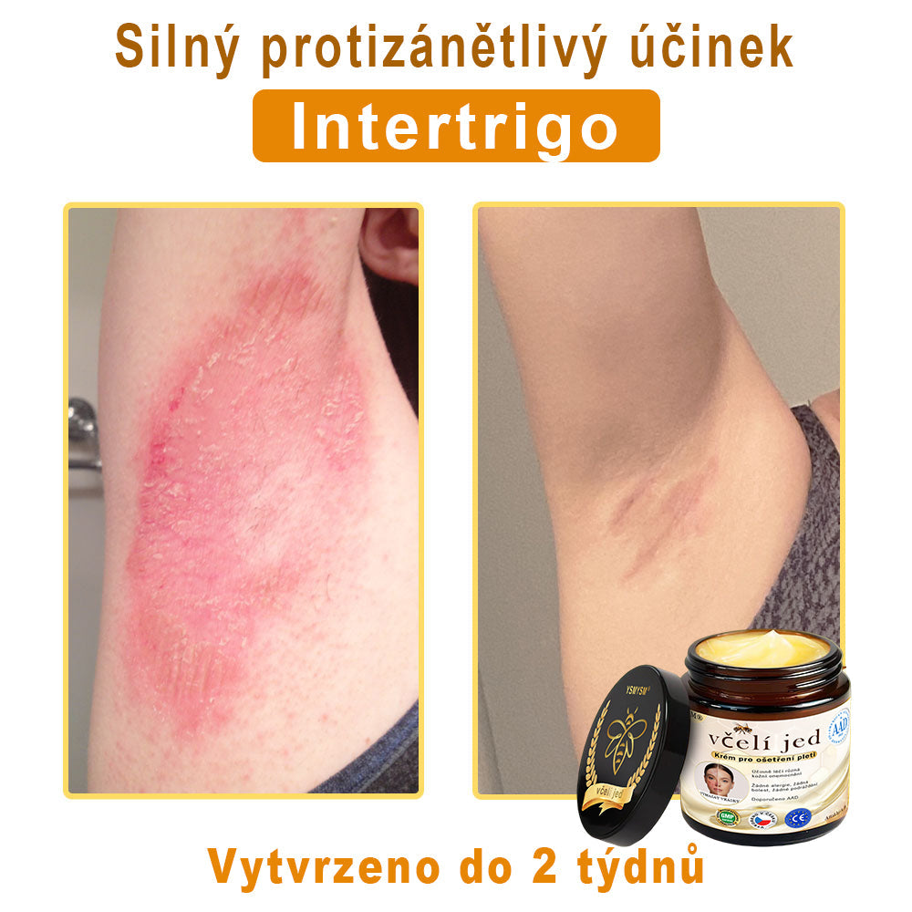 💥Doporučeno Univerzitní nemocnicí Motok | Oficiální obchod | YSMYSM® Krém na opravu pleti pro celé tělo: proti stárnutí, hydratace, oprava pleti, sjednocení tónu pleti, léčba akné a tmavých skvrn, odstraňování bradavic a znamének, úleva při psoriáze