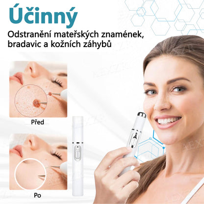 Foulme® PRO Neinvazivní laserové pero na odstraňování bradavic a znamének
