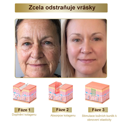 PLTOWE® Silný krém na ošetření pokožky celého těla