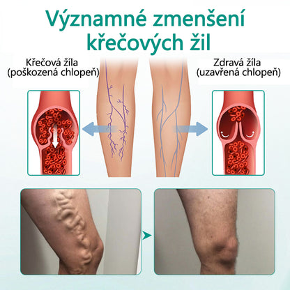 [Oficiální obchod značky]Timilk® Obnova nohou náplast na křečové žíly