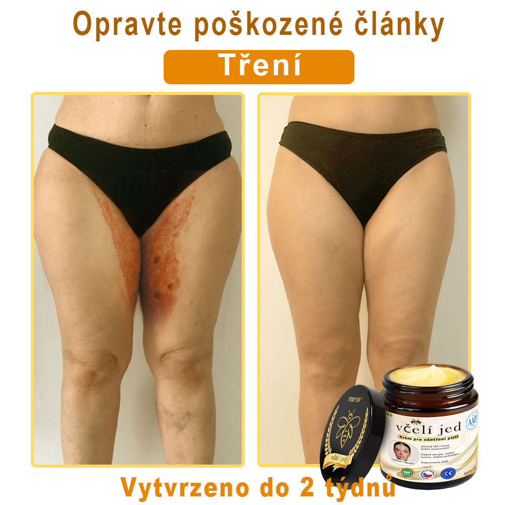 💥Doporučeno Univerzitní nemocnicí Motok | Oficiální obchod | YSMYSM® Krém na opravu pleti pro celé tělo: proti stárnutí, hydratace, oprava pleti, sjednocení tónu pleti, léčba akné a tmavých skvrn, odstraňování bradavic a znamének, úleva při psoriáze