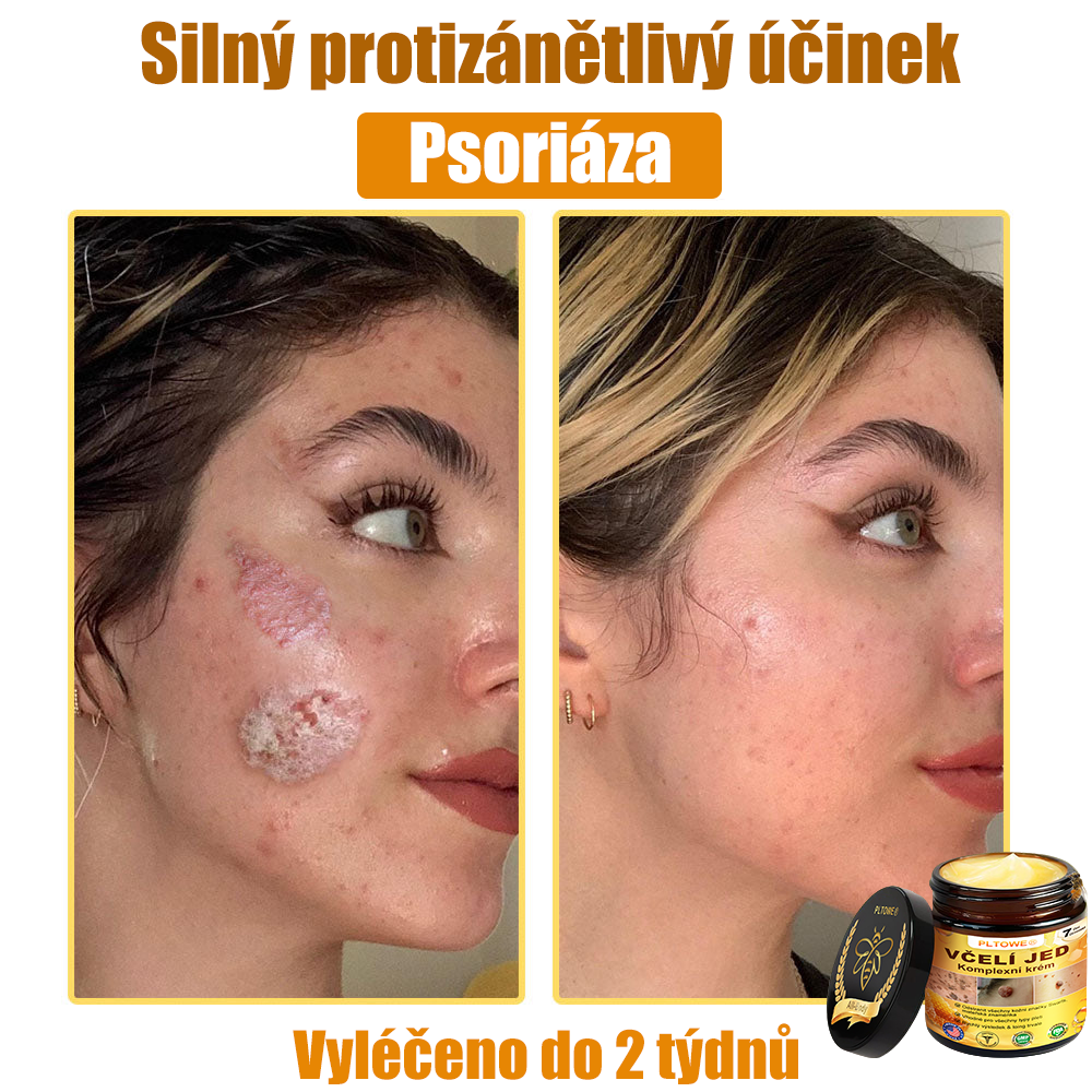 💥💥PLTOWE® Včelí jed All-in-One krém Schváleno dermatologem