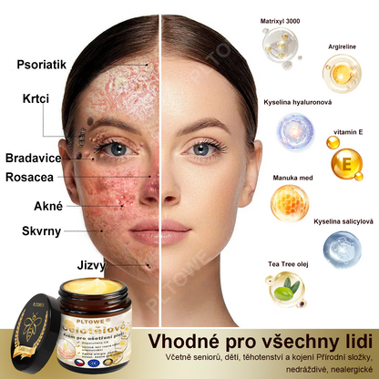 PLTOWE® Silný krém na ošetření pokožky celého těla