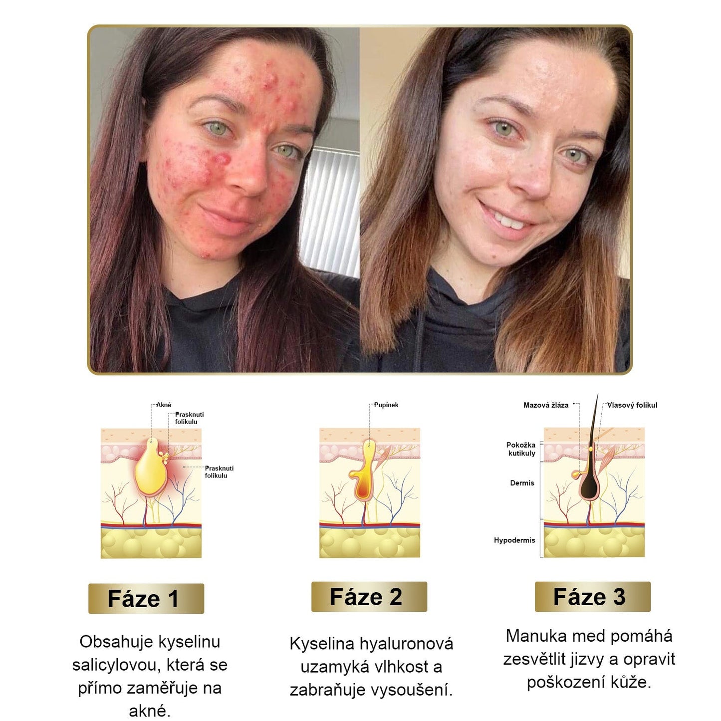 PLTOWE® Silný krém na ošetření pokožky celého těla