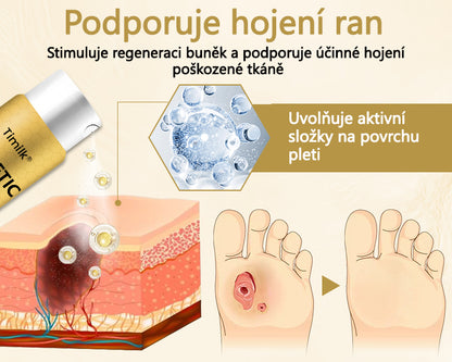 【Oficiální značkový obchod】Timilk® Sprej na hojení diabetické nohy - s obsahem včelího jedu