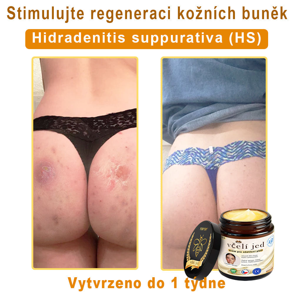 💥Doporučeno Univerzitní nemocnicí Motok | Oficiální obchod | YSMYSM® Krém na opravu pleti pro celé tělo: proti stárnutí, hydratace, oprava pleti, sjednocení tónu pleti, léčba akné a tmavých skvrn, odstraňování bradavic a znamének, úleva při psoriáze