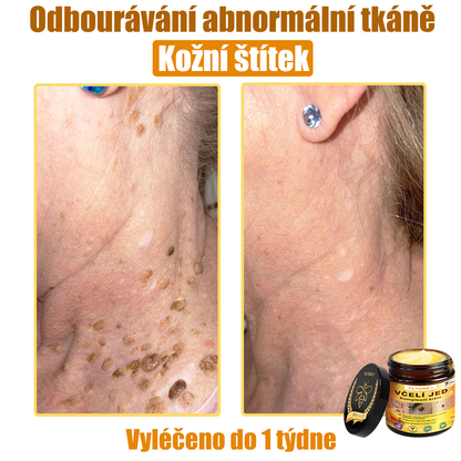 💥💥PLTOWE® Včelí jed All-in-One krém Schváleno dermatologem