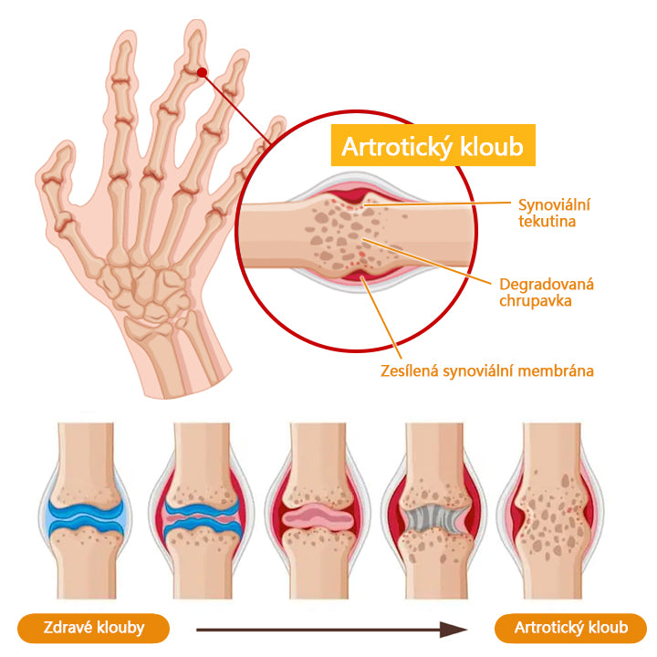 ✅[Oficiální obchod značky]Biancat™ Krém na obnovu kloubů se včelím jedem