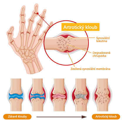 ✅[Oficiální obchod značky]Biancat™ Krém na obnovu kloubů se včelím jedem