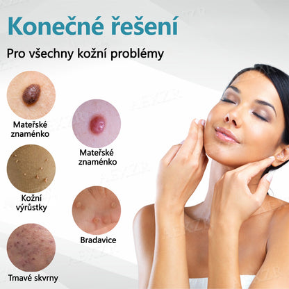 Foulme® PRO Neinvazivní laserové pero na odstraňování bradavic a znamének